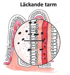 Läckande tarm